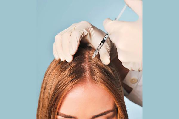 Hair Mesotherapy